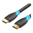 Vention® HDMI Cable 2M Black (AACBH)